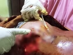 Sedang Menyuluh Ikan, Warga Desa Sahu Di Terkam Buaya