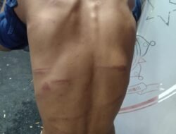 Sadis…… Dituduh Mencuri Bebek, 2 Bocah Dianiaya Hingga Dilucuti Selang Air.