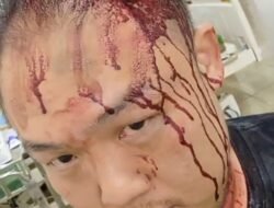 Tegur Pesta Miras Tengah Malam, Warga Siantar Utara Luka Robek di Kepala Dianiaya Oknum Ormas