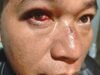 Diduga Dipicu Persoalan Mobil Bernopol Palsu, Pria di Batam Jadi Korban Pengeroyokan Brutal